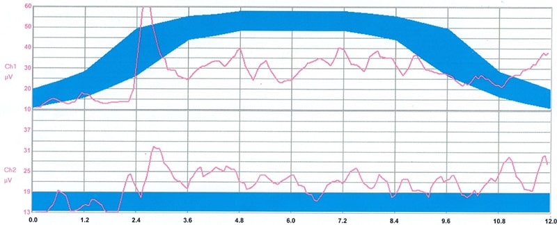 Endurance Squeeze contraction