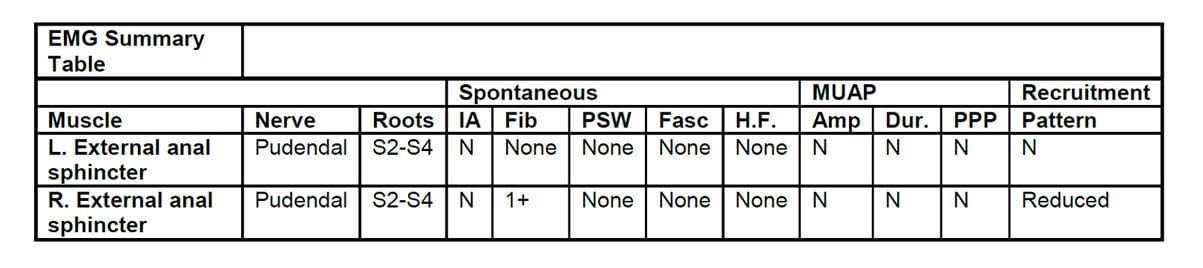 needle electromyography